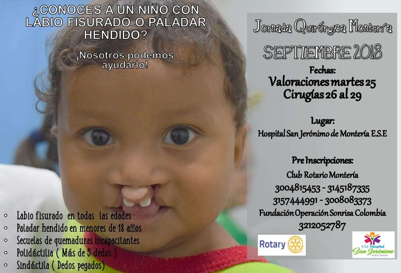 En Montería realizarán jornada quirúrgica para niños con labios fisurados y paladar hendido