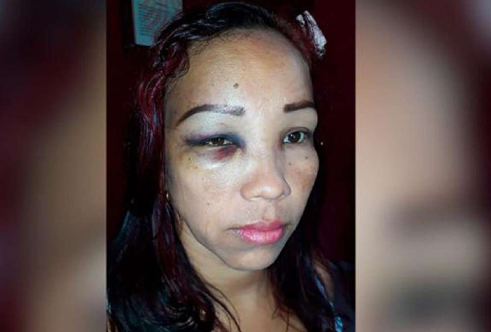 Mujer denunció que fue brutalmente golpeada por policías